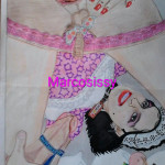 marcosissy-prolapso-anal