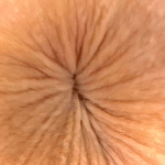 1000200617-2