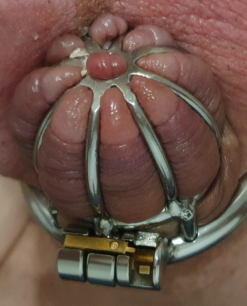 1000225815