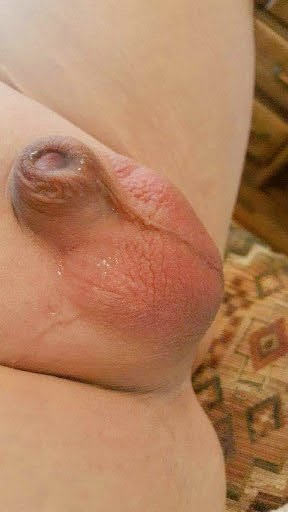 1000258017