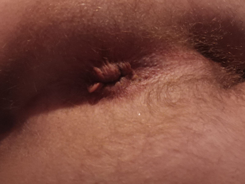 1000072502