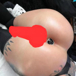 1000028017